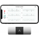 جهاز AliveCor KardiaMobile 6L الذكي لقياس تخطيط كهربية القلب / معتمد من هيئة الادوية الامريكية