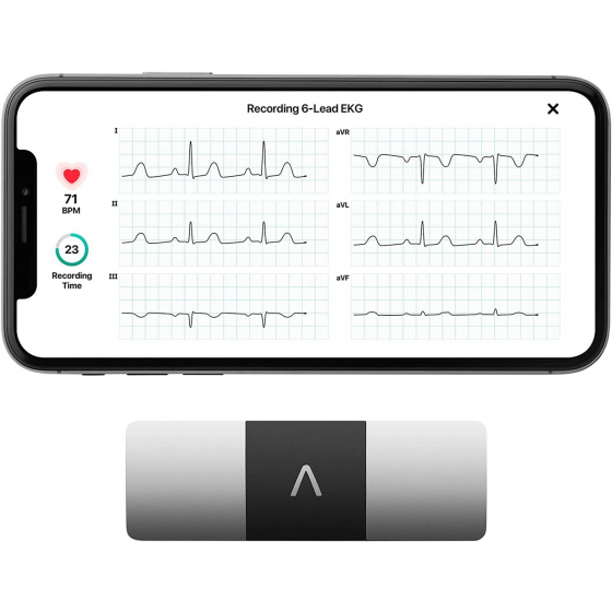 جهاز AliveCor KardiaMobile 6L الذكي لقياس تخطيط كهربية القلب / معتمد من هيئة الادوية الامريكية